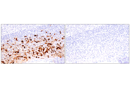 Immunohistochemistry Image 9: S100B (E7C3A) Rabbit mAb
