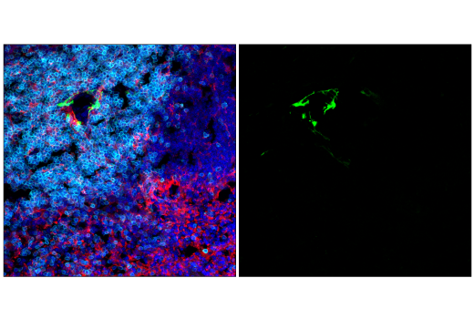 Immunofluorescence Image 1: S100B (E7C3A) Rabbit mAb