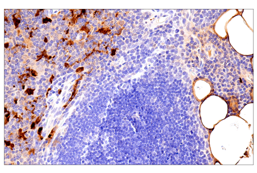 Immunohistochemistry Image 7: S100B (E7C3A) Rabbit mAb