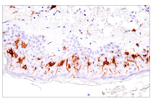 Immunohistochemistry Image 2: CD1A (MTB1) Mouse mAb