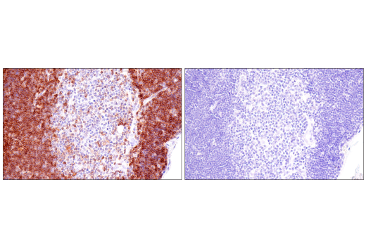 Immunohistochemistry Image 5: CD1A (MTB1) Mouse mAb