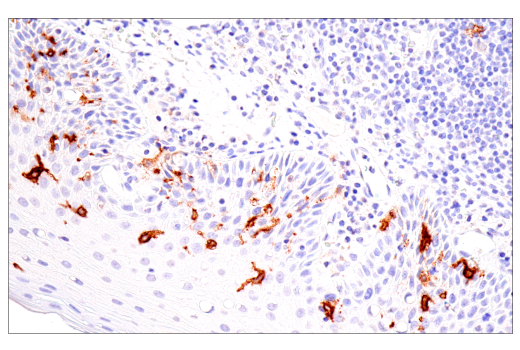 Immunohistochemistry Image 3: CD1A (MTB1) Mouse mAb