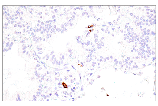 Immunohistochemistry Image 4: CD1A (MTB1) Mouse mAb