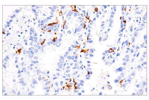 Immunohistochemistry Image 1: CD1A (MTB1) Mouse mAb