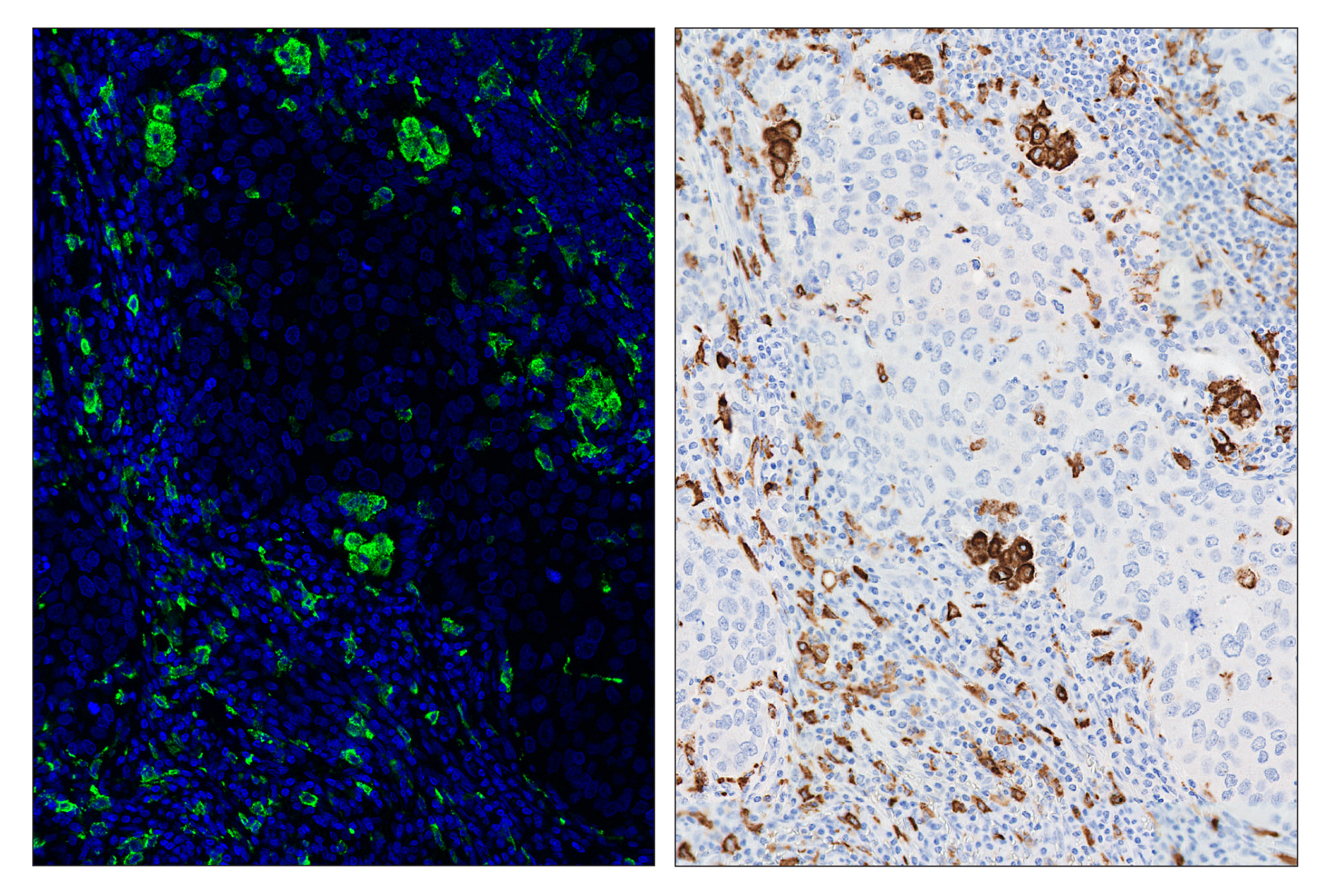 Immunohistochemistry Image 6: CD206/MRC1 (E2L9N) & CO-0035-488 SignalStar™ Oligo-Antibody Pair
