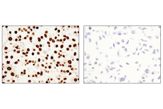 Immunohistochemistry Image 3: HOXB13 (D7N8O) Rabbit mAb (BSA and Azide Free)