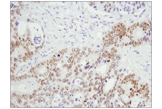 Immunohistochemistry Image 2: HOXB13 (D7N8O) Rabbit mAb (BSA and Azide Free)