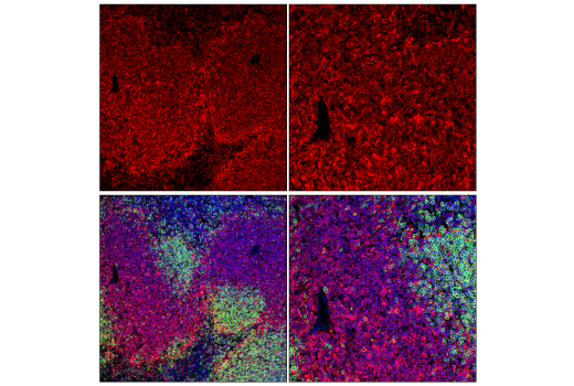 Immunofluorescence Image 2: STING (E9X7F) Rabbit mAb