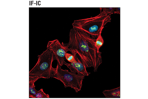  Image 19: Mouse Microglia Marker IF Antibody Sampler Kit