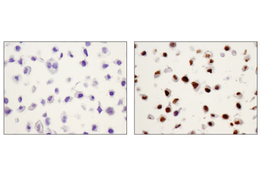  Image 39: ALK Activation Antibody Sampler Kit
