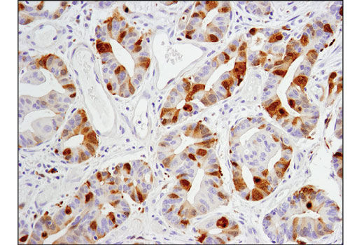 Immunohistochemistry Image 1: Aurora A (D3V7T) XP® Rabbit mAb