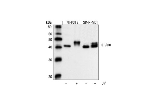  Image 7: PhosphoPlus® c-Jun (Ser73) Antibody Duet