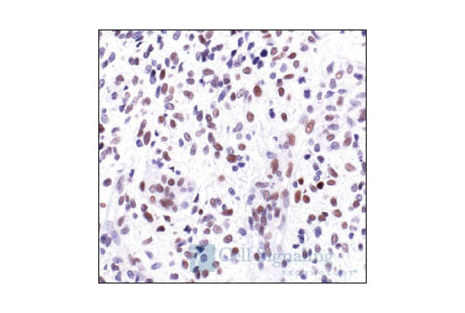  Image 16: PhosphoPlus® c-Jun (Ser63) and c-Jun (Ser73) Antibody Kit