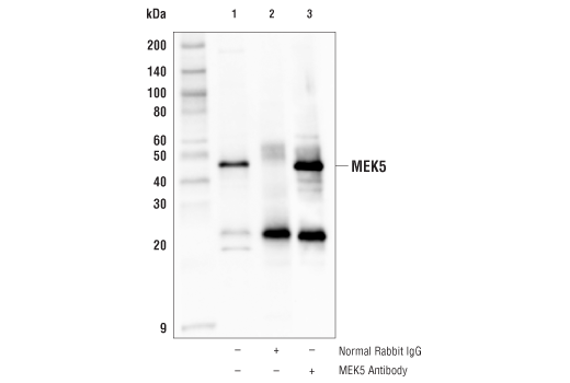 Immunoprecipitation Image 1: MEK5 Antibody