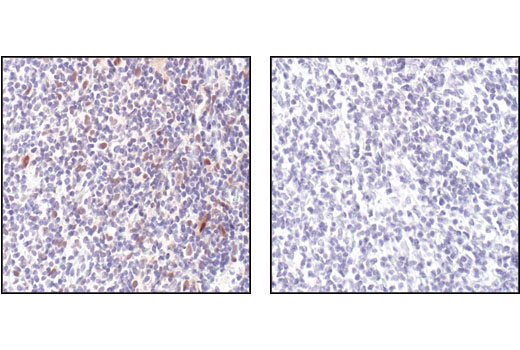  Image 21: Human Reactive M1 vs M2 Macrophage IHC Antibody Sampler Kit