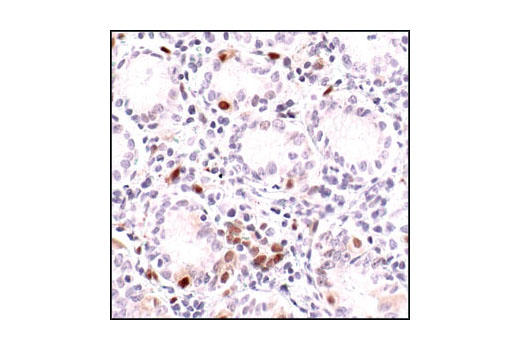  Image 34: Human Reactive M1 vs M2 Macrophage IHC Antibody Sampler Kit