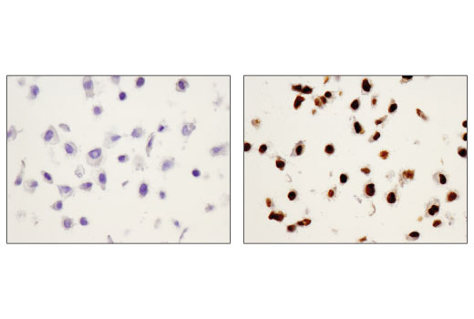  Image 32: Human Reactive M1 vs M2 Macrophage IHC Antibody Sampler Kit