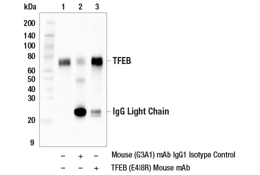 Immunoprecipitation Image 1: TFEB (E4I8R) Mouse mAb