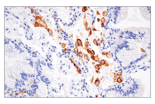 Immunohistochemistry Image 1: CD86 (E2G8P) Rabbit mAb