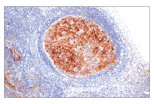 Immunohistochemistry Image 3: CD86 (E2G8P) Rabbit mAb