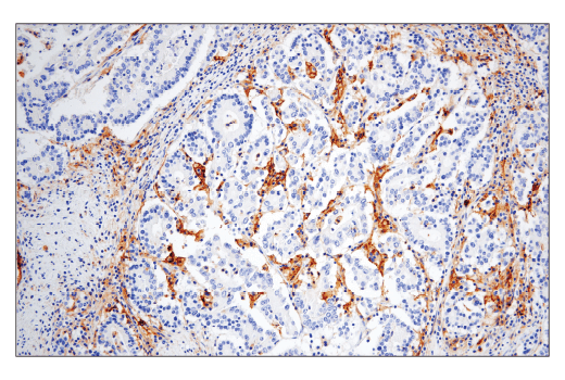 Immunohistochemistry Image 5: CD86 (E2G8P) Rabbit mAb