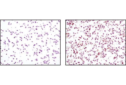  Image 13: PTEN and PDK1 Antibody Sampler Kit II