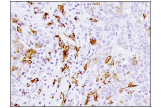  Image 27: Human Reactive M1 vs M2 Macrophage IHC Antibody Sampler Kit