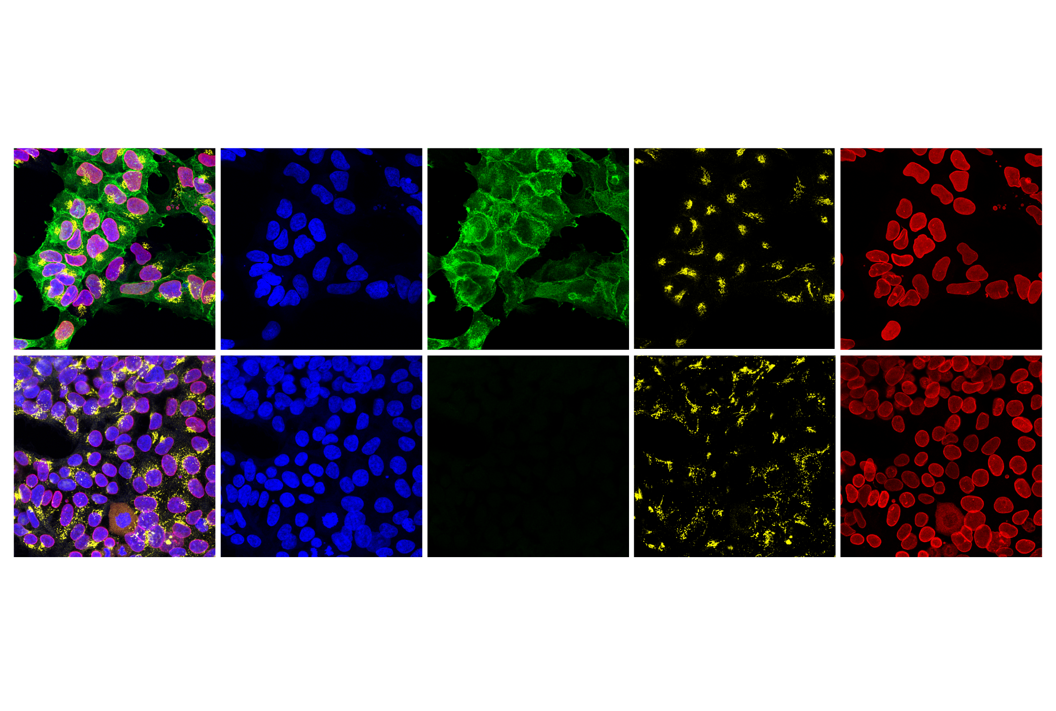 Immunofluorescence Image 2: Myc-Tag (E7F9B) Mouse mAb