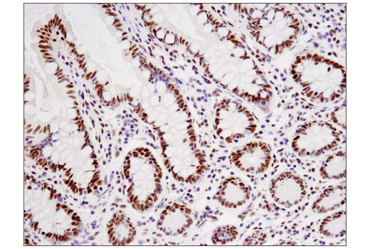  Image 13: NSD Family Antibody Sampler Kit