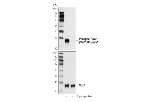  Image 2: PhosphoPlus® Sox2 (Ser250/Ser251) Antibody Duet