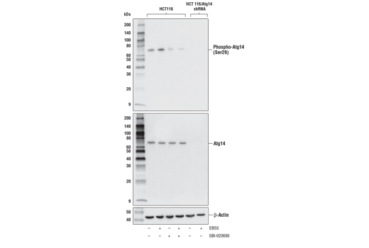  Image 18: ULK1 Substrate Antibody Sampler Kit