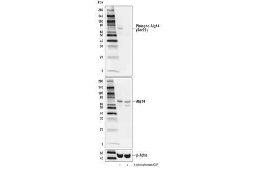  Image 24: ULK1 Substrate Antibody Sampler Kit