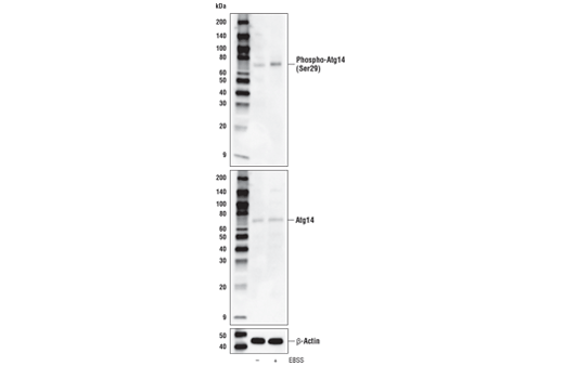  Image 28: ULK1 Substrate Antibody Sampler Kit