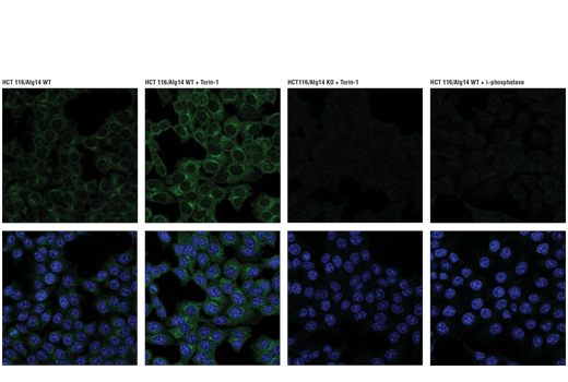 Immunofluorescence Image 1: Phospho-Atg14 (Ser29) (D4B8M) Rabbit mAb