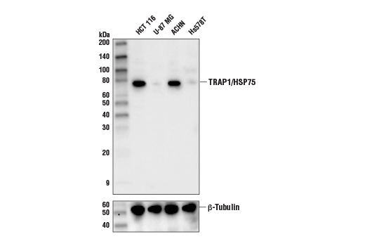 Western Blotting Image 1: TRAP1/HSP75 (D3D7N) Rabbit mAb
