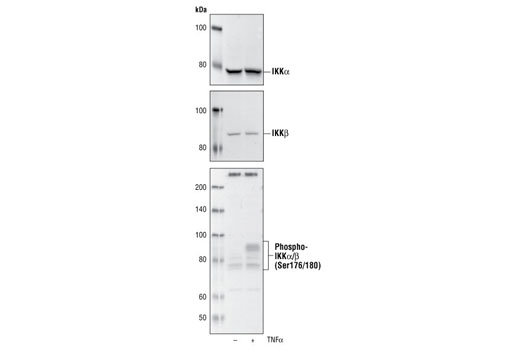  Image 4: PhosphoPlus® IκBα (Ser32/36) Antibody Kit