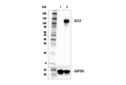  Image 12: SARS-CoV-2 Virus-Host Interaction Antibody Sampler Kit