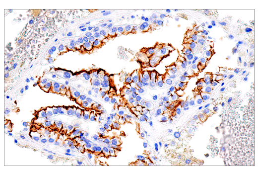  Image 14: SARS-CoV-2 Virus-Host Interaction Antibody Sampler Kit