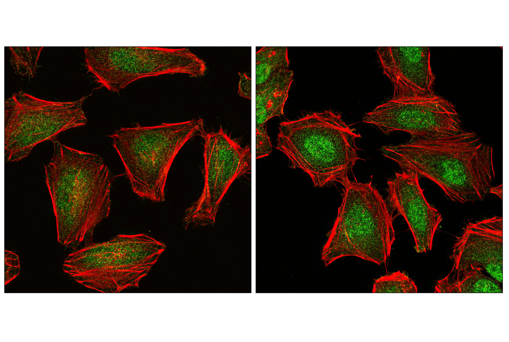 Immunofluorescence Image 1: Phospho-SAPK/JNK (Thr183/Tyr185) (G9) Mouse mAb