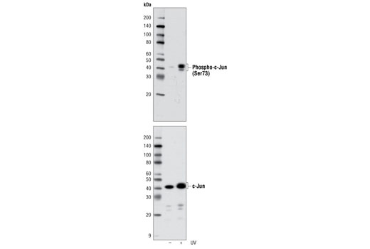  Image 8: PhosphoPlus® c-Jun (Ser63) and c-Jun (Ser73) Antibody Kit