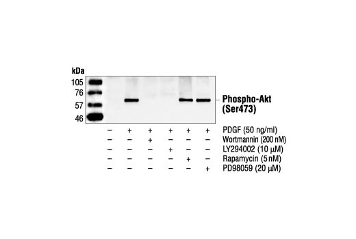 Western Blotting Image 1: Phospho-Akt (Ser473) Antibody