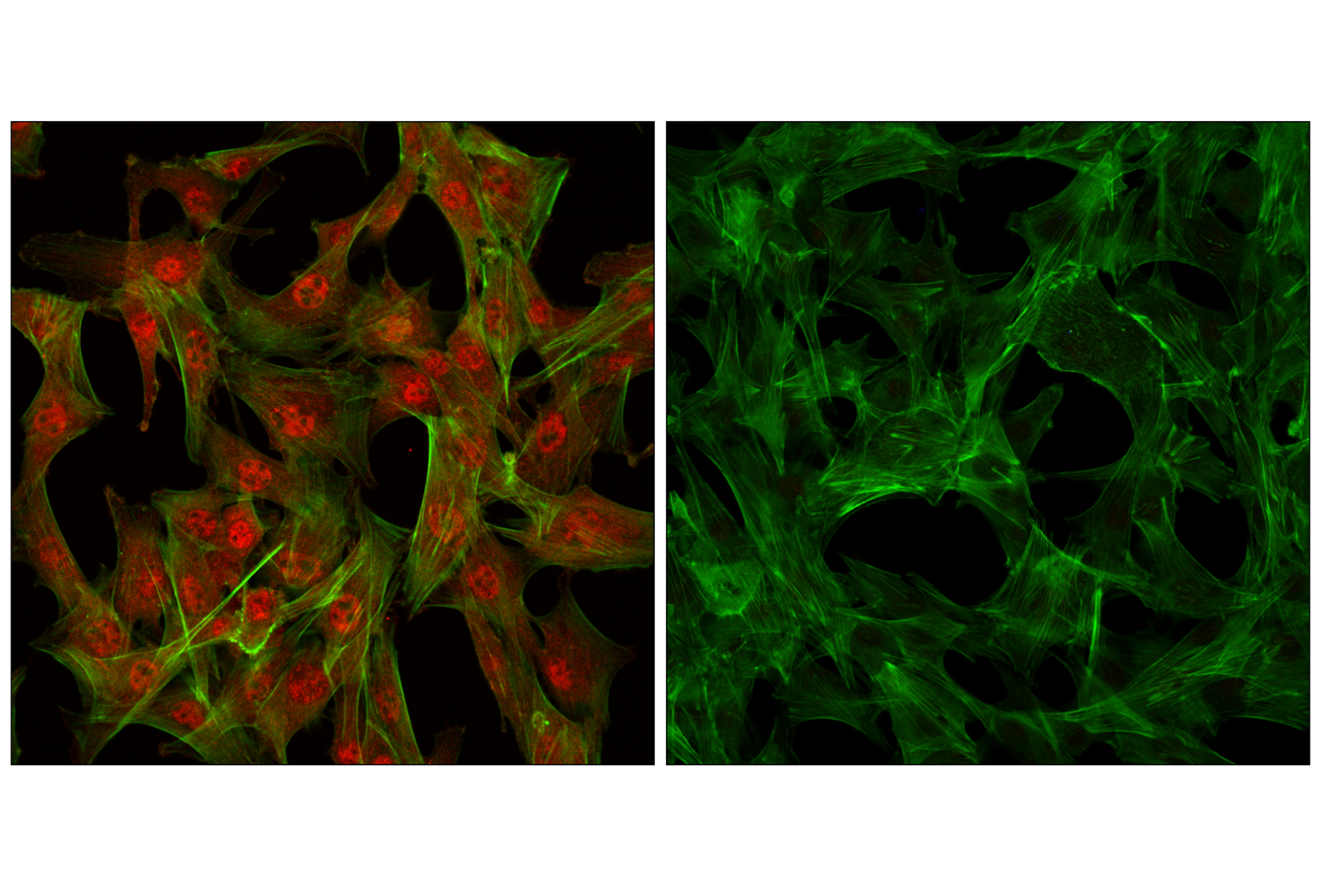 Immunofluorescence Image 1: Akt Antibody