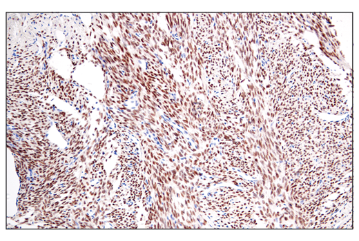 Immunohistochemistry Image 1: SS18-SSX (E9X9V) XP® Rabbit mAb (BSA and Azide Free)