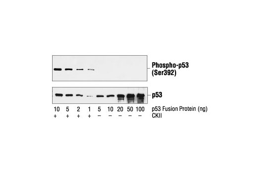  Image 6: Phospho-p53 Antibody Sampler Kit