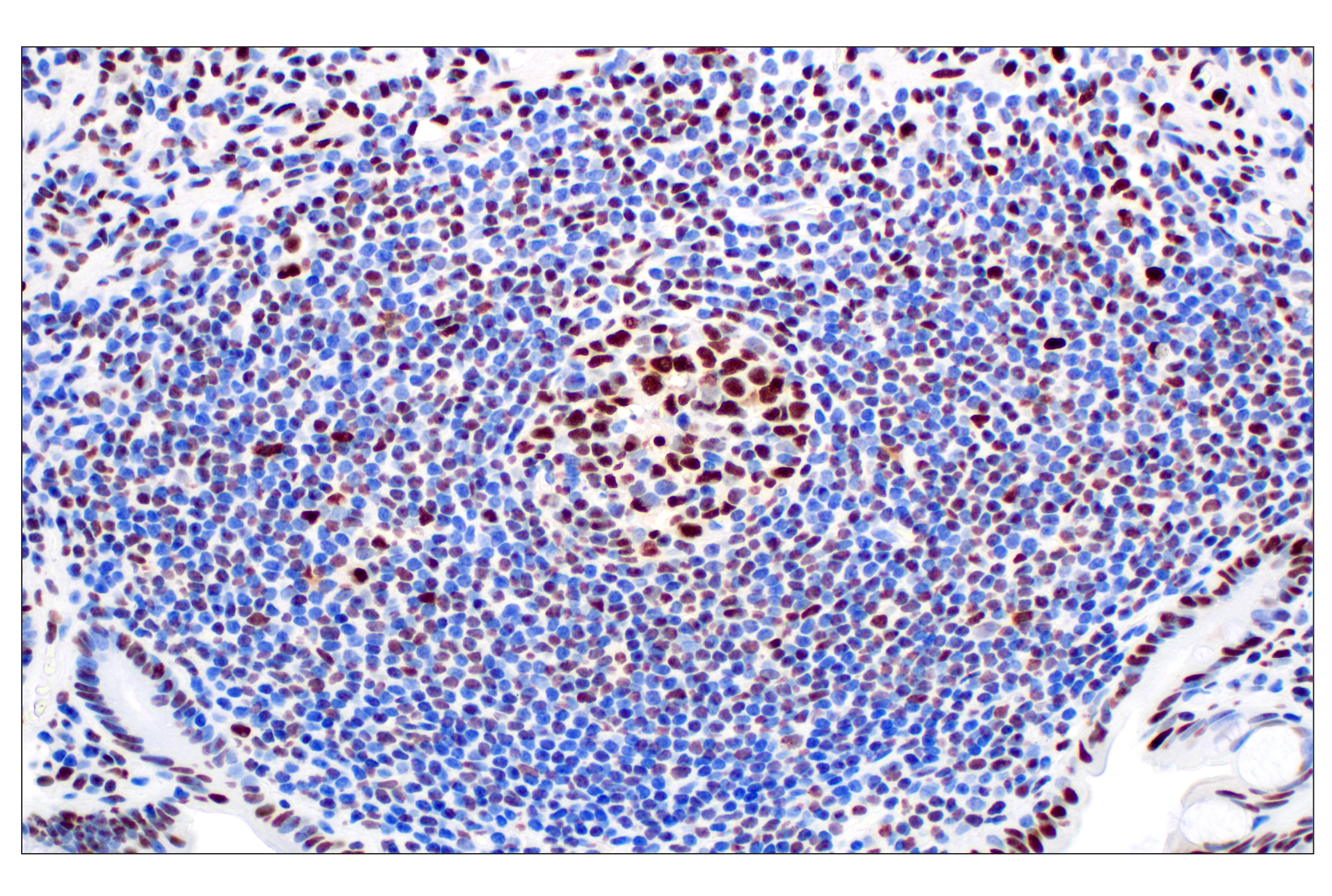 Immunohistochemistry Image 6: NPM1 (E7W4P) Rabbit mAb