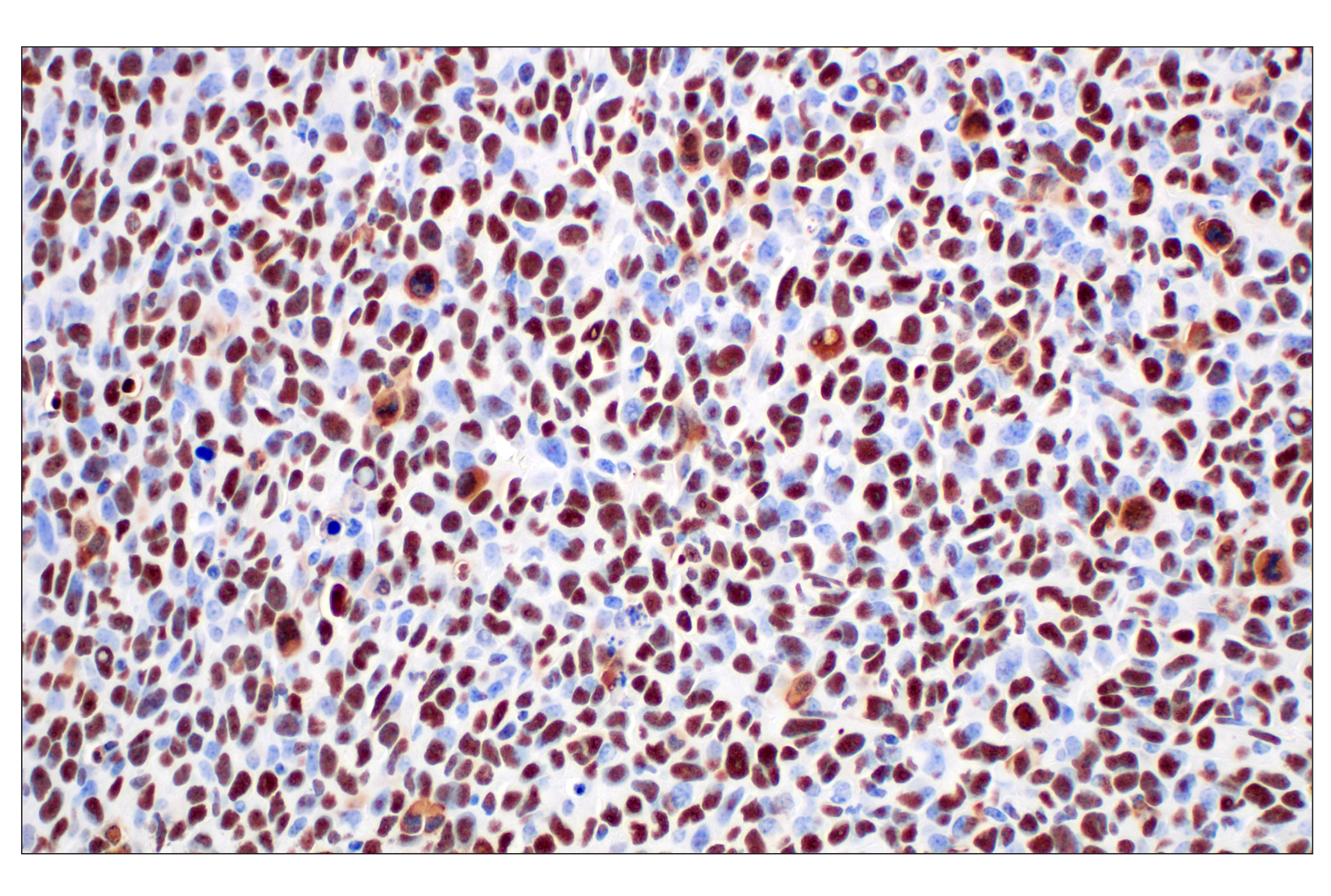 Immunohistochemistry Image 8: NPM1 (E7W4P) Rabbit mAb
