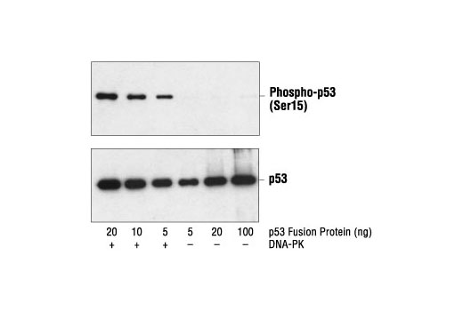  Image 9: p53 Antibody Sampler Kit