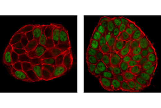 Immunofluorescence Image 1: Phospho-p53 (Ser15) (16G8) Mouse mAb (BSA and Azide Free)