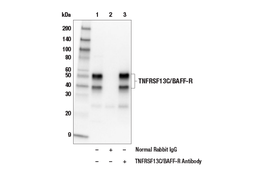 Immunoprecipitation Image 1: TNFRSF13C/BAFF-R Antibody