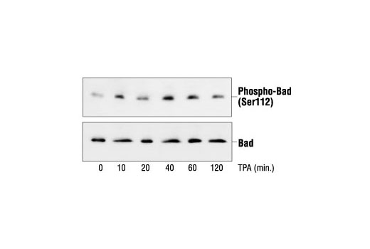 Western Blotting Image 1: Phospho-Bad (Ser112) (7E11) Mouse mAb